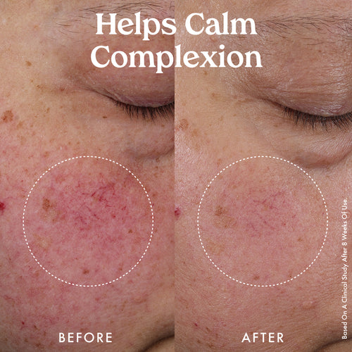 Nourishing Hydro-Lipid Barrier Serum 