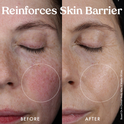 Nourishing Hydro-Lipid Barrier Serum 