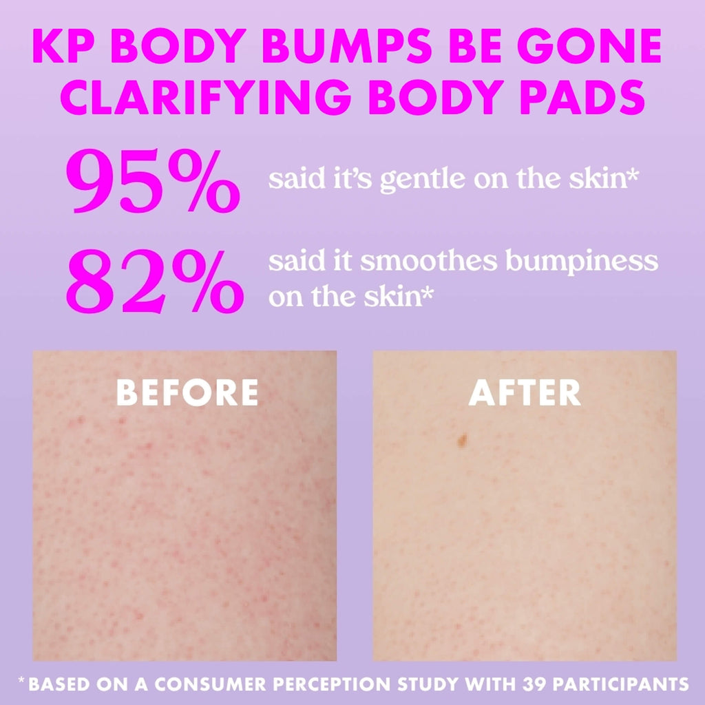 KP Body Bumps Be Gone Clarifying Body Pads