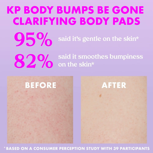 KP Body Bumps Be Gone Clarifying Body Pads 