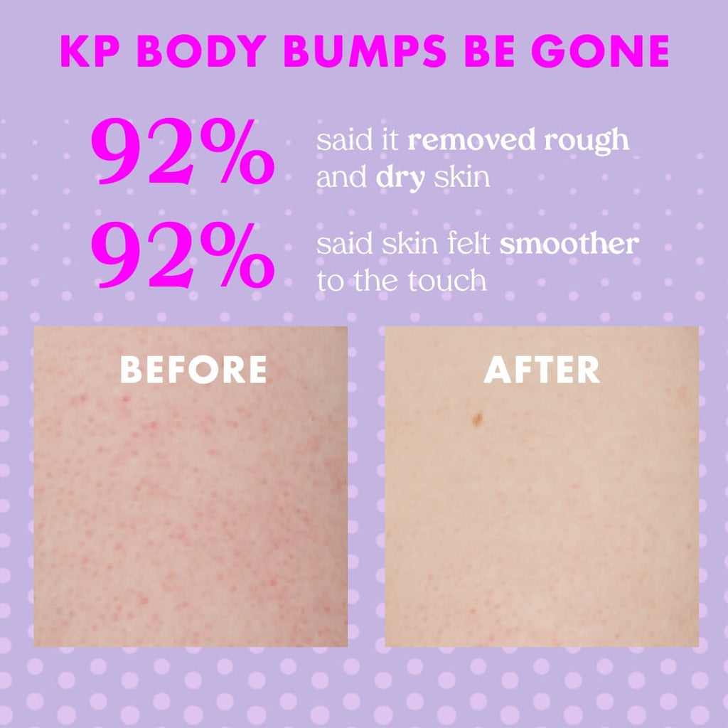 KP Body Bumps Be Gone With 10% AHA Clarifying Body Scrub